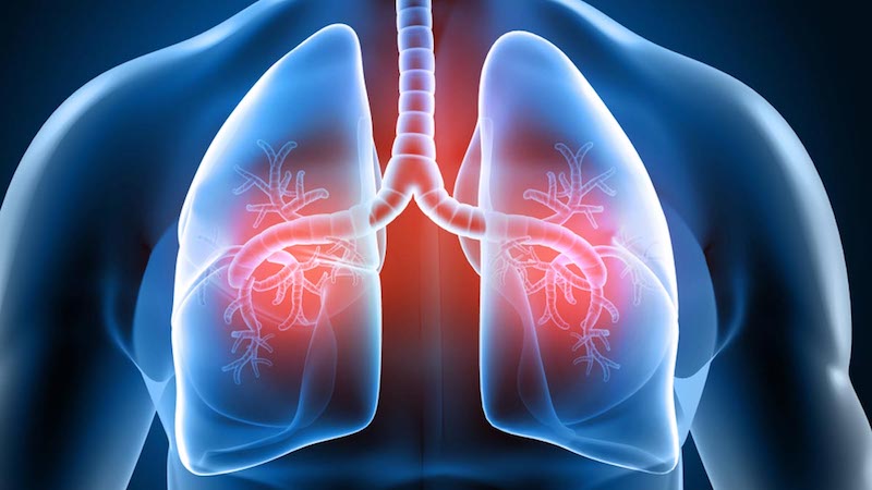 Co łączy astmę oskrzelową z zakażeniem mykoplazmą i chlamydią.